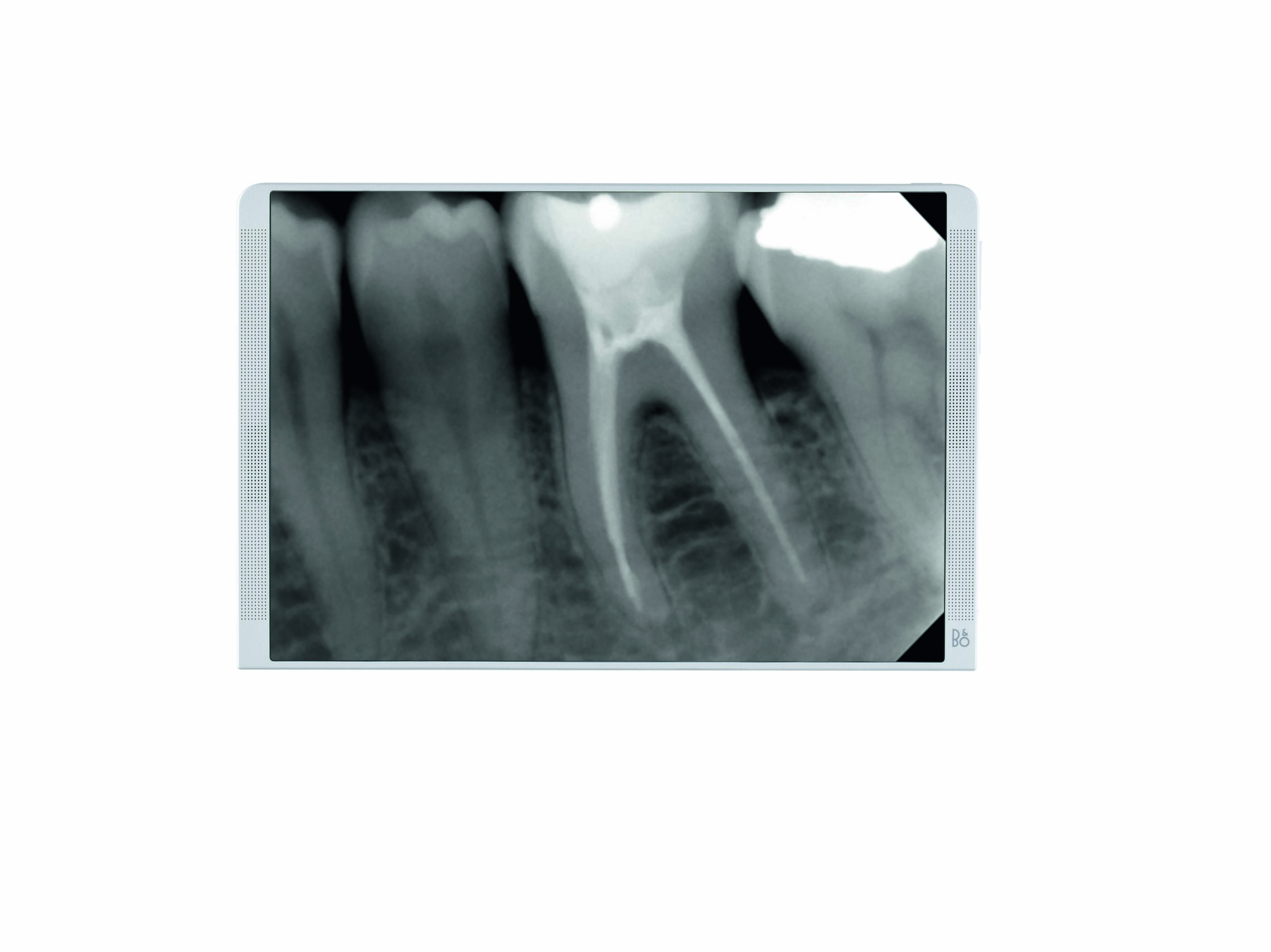 NewTom RX DC Wired – Precizan intraoralni X-ray